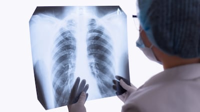 X-ray Regulations Detailed In New FDA Guidance