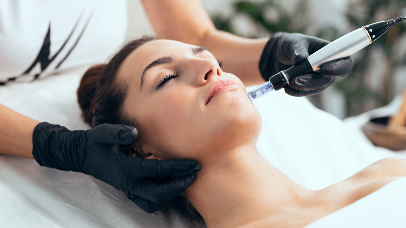 How Microneedling Treatments Support Smoother and Healthier-Looking Skin